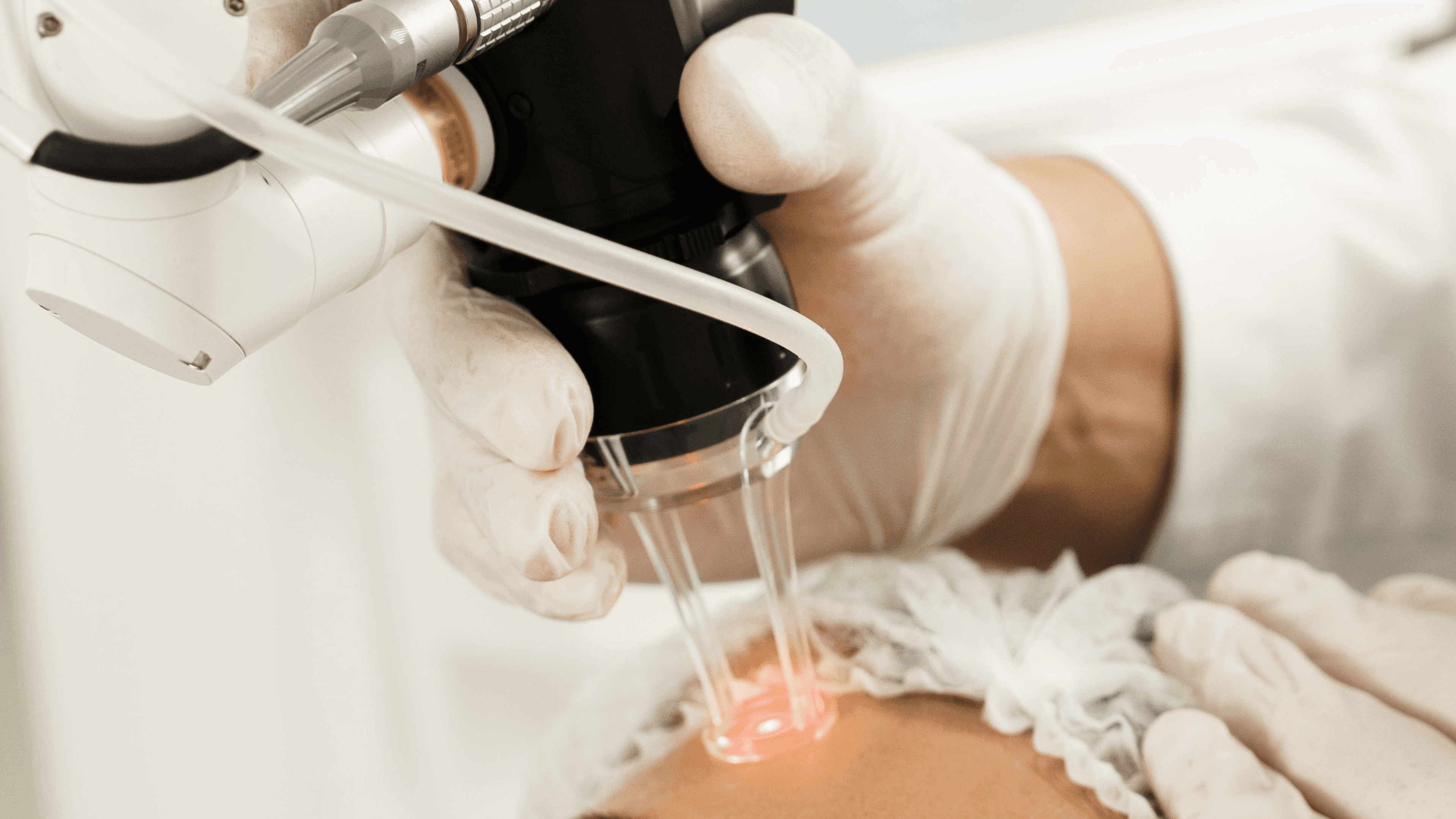 Fractional Laser