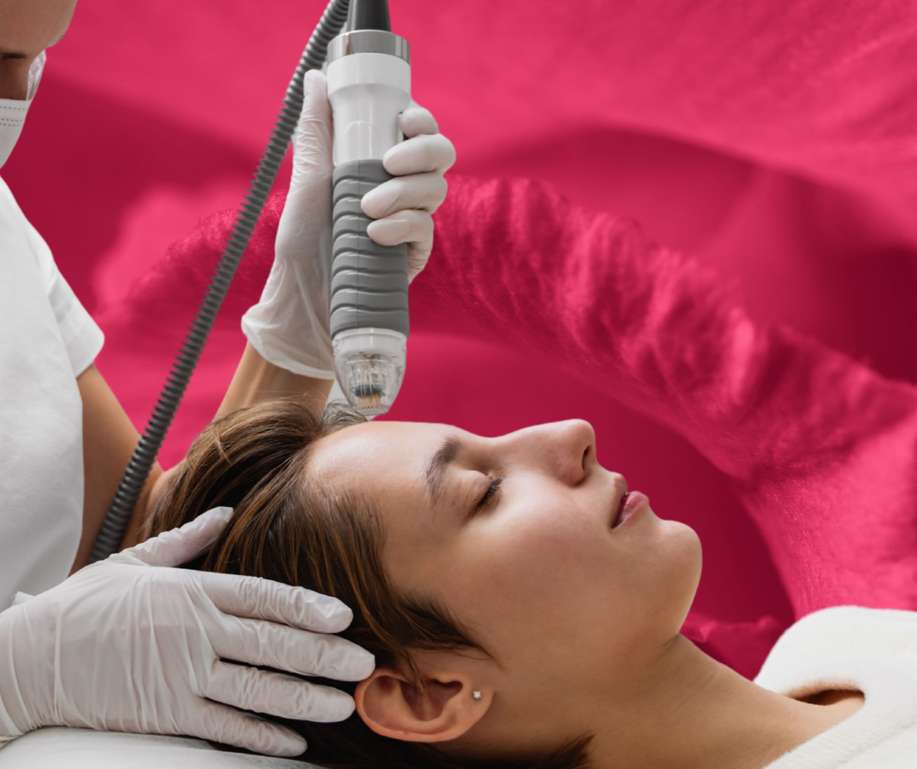 Microneedling RF