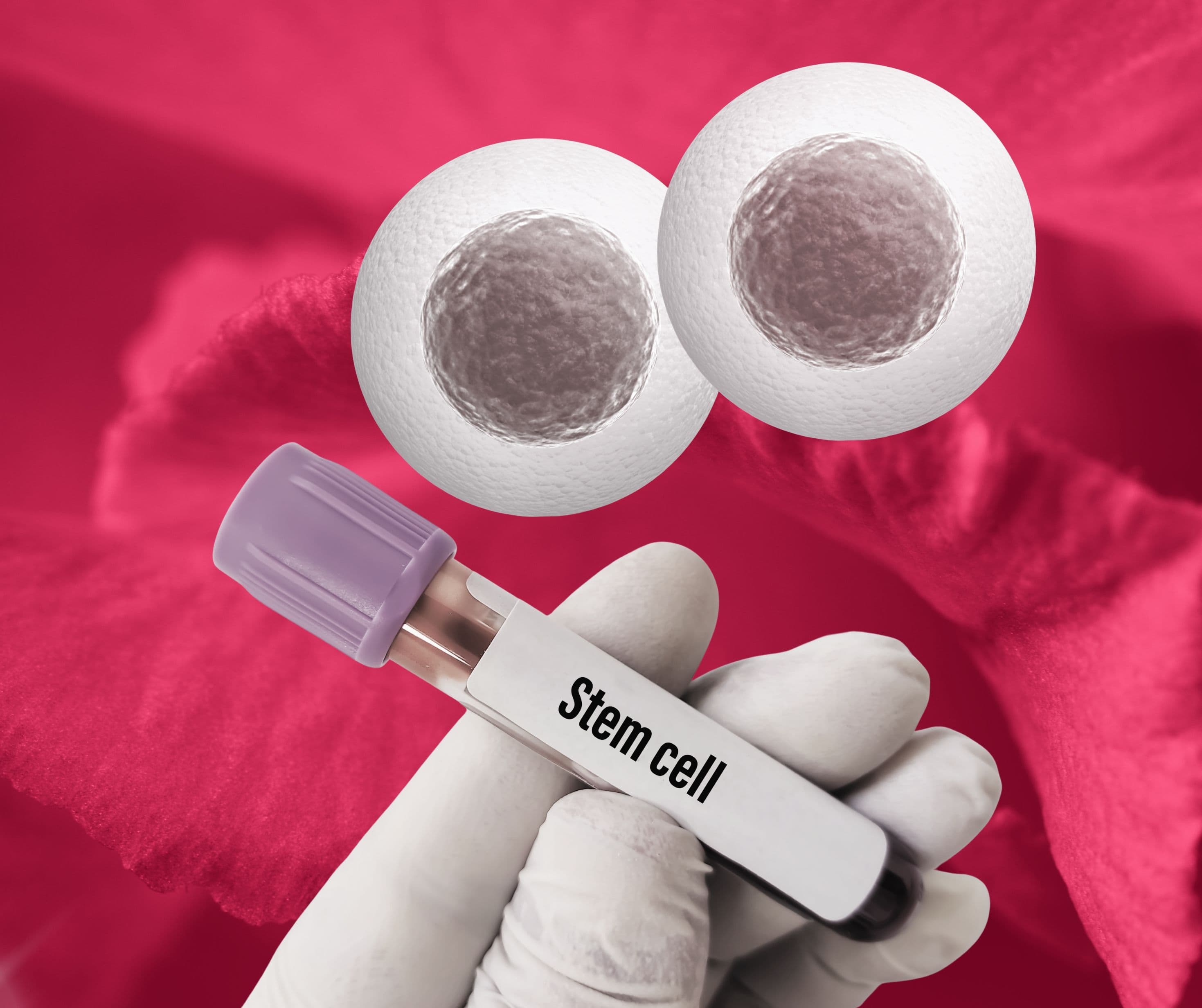 Stem Cell Therapy
