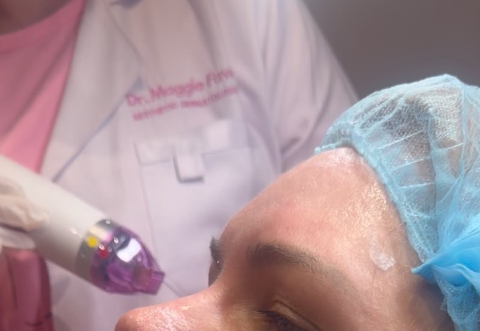 Clinical microneedling procedure being performed with protective equipment