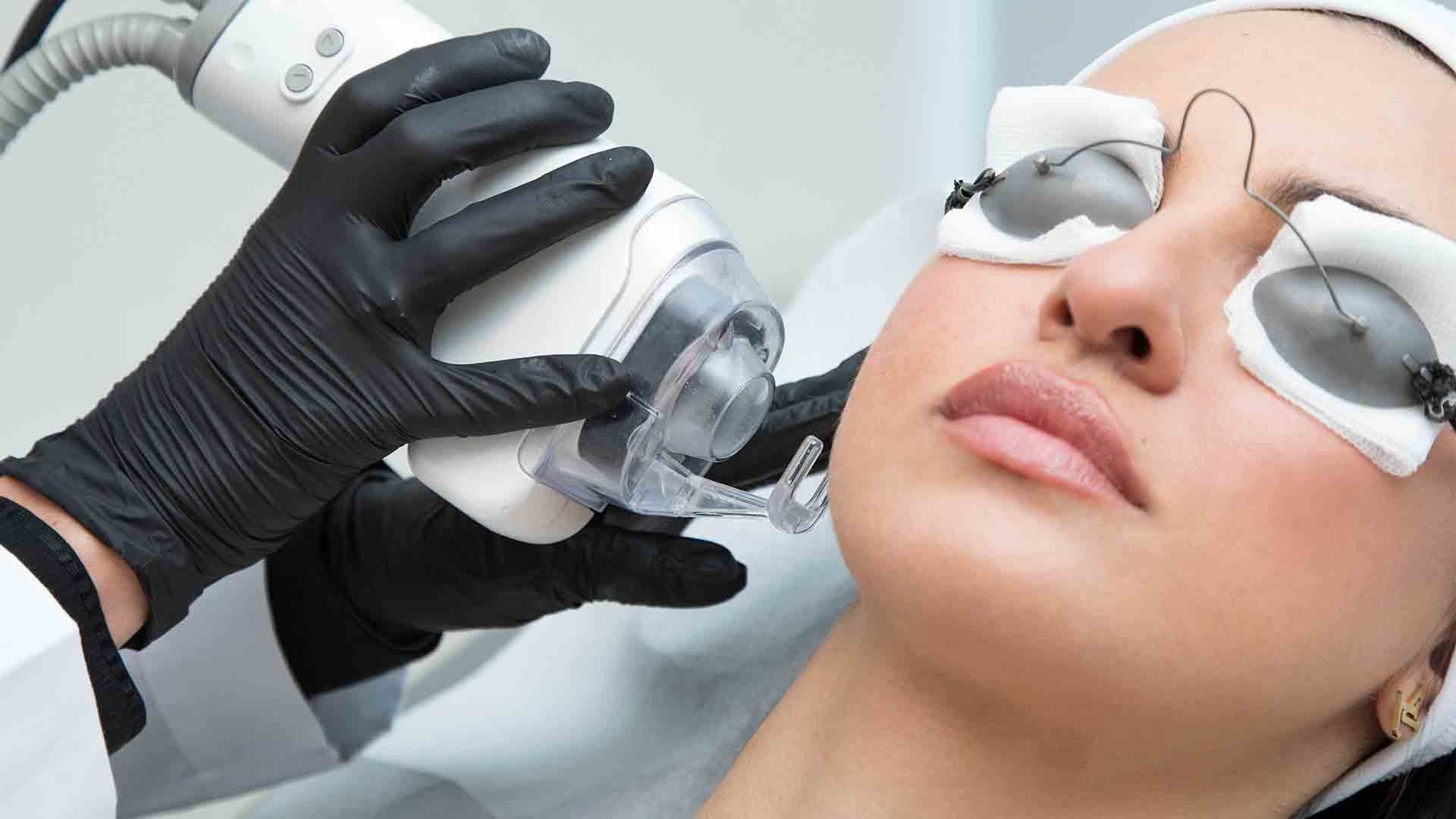 Fractional Laser Treatment at Magenta Clinique Maadi